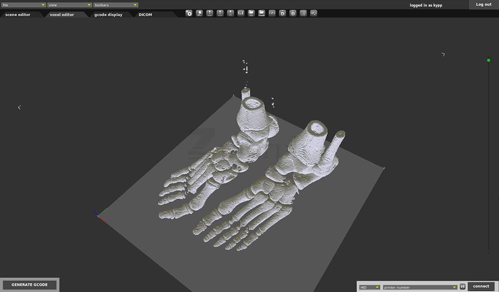 Dicom2-Voxelizer