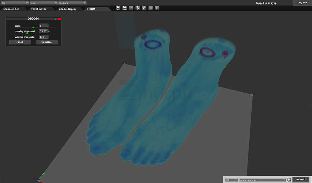 Dicom3-Voxelizer